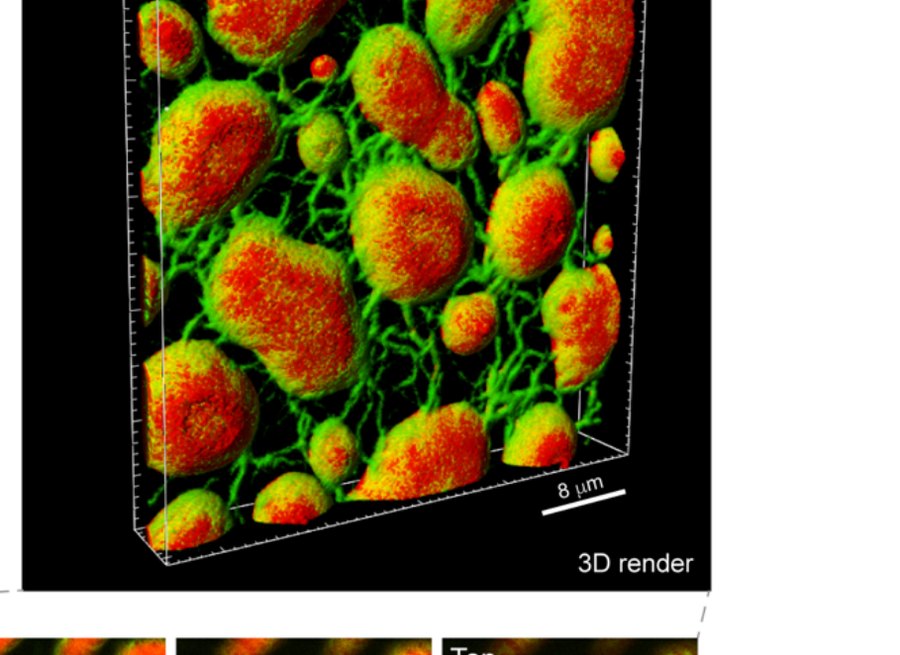 Figure 1: 3D render of condensates with amyloid fibrils growing on the outside